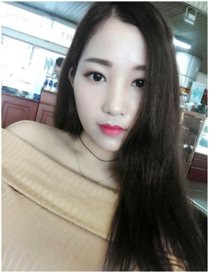 비절개눈매교정 1년 지났어요~ 