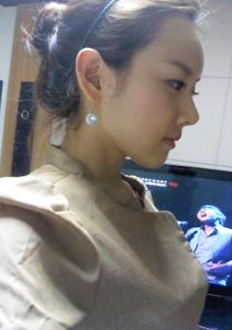 김사장 수술한지 17일째... 수술전+당일+10일째+현재...