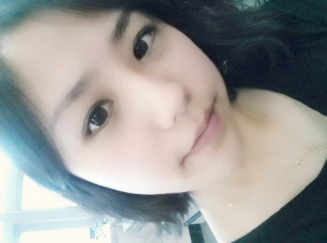 103일째!!!! 비절개눈매교정 앞뒤트임