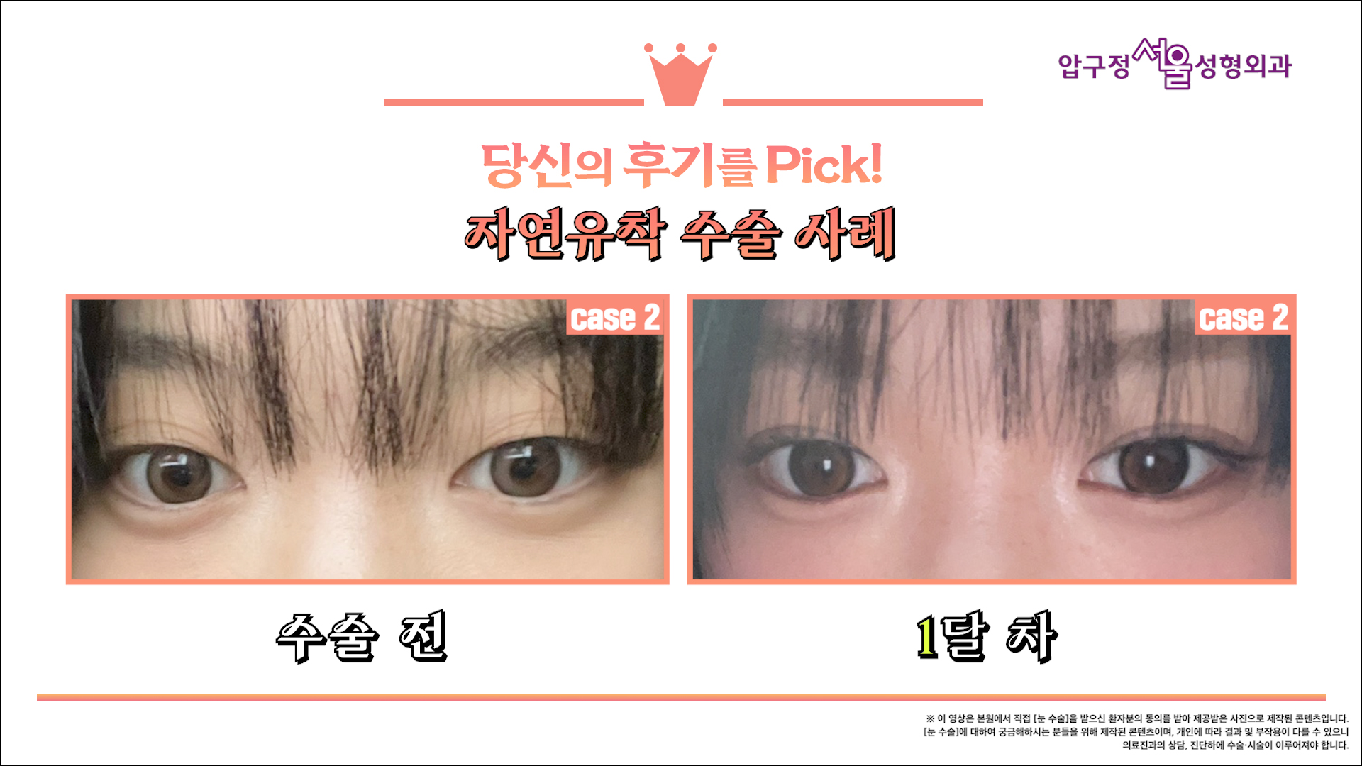 영상 썸네일