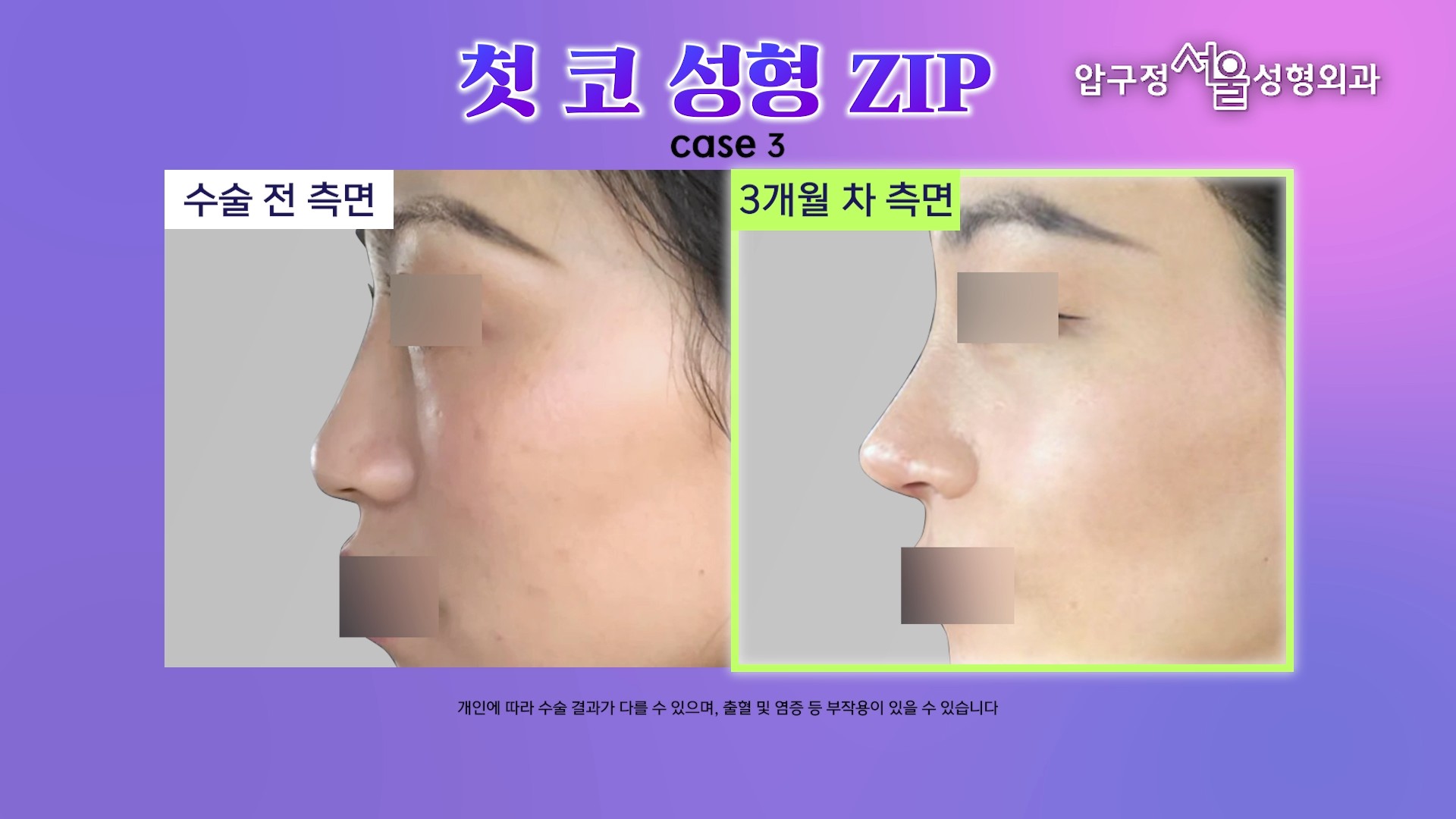 영상 썸네일