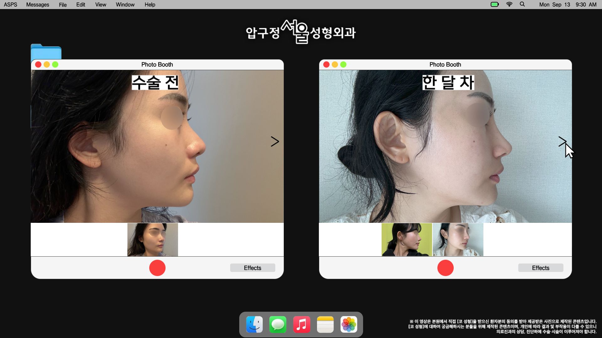 영상 썸네일