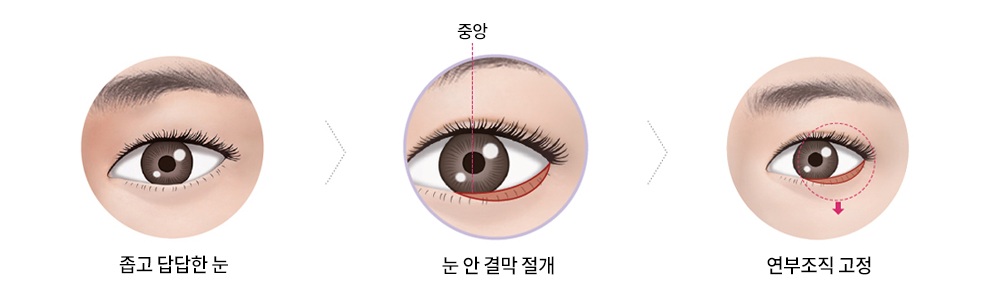 ������� - �ݰ� ����� ��, �� �� �ḷ ����, �������� ����